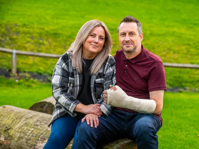Dan Parry, from Harrogate, sliced his thumb off in a DIY accident but had it saved by surgeons at LGI.