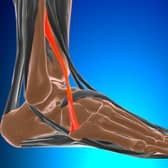 Peroneus tertius muscle. Picture: Adobe