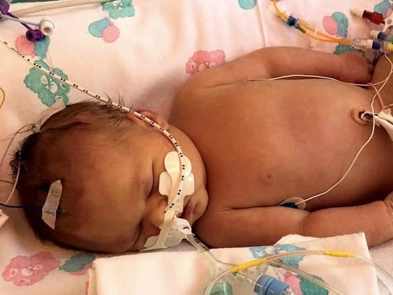 Baby Matilda Pickup was born brain damaged following complications in her birth at Harrogate District Hospital