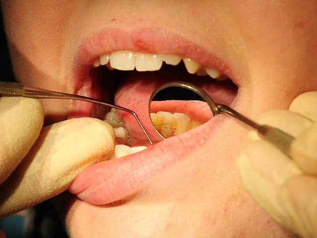 The impact of the coronavirus pandemic on dental care has been laid bare by new figures revealing a slump in treatments delivered to North Yorkshire patients.
