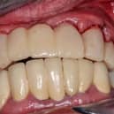 Maintaining good oral health is so important. Photo: StockAdobe
