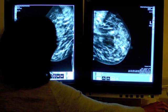 Thousands of Harrogate women are missing their breast cancer screening checks as appointment levels hit an all-time national low.
(Credit: Radar)