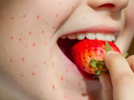 One in four people with food allergies taken ill while dining out